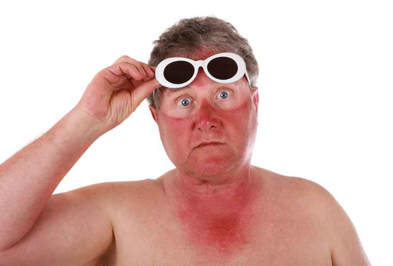 An diesen 10 Symptomen erkennt man einen Sonnenstich - Fritzguide